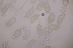Puccinia salviae