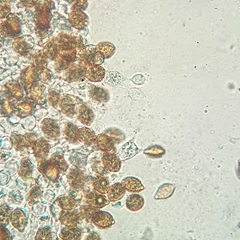 Descomyces