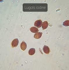 Descomyces