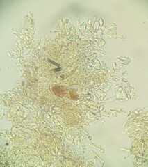 Crustodontia chrysocreas