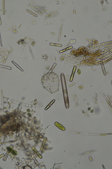 Euglypha strigosa