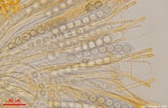 Ramsbottomia asperior