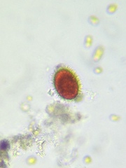 Chlainomonas