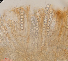 Pulvinula convexella
