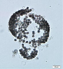 Microcystis wesenbergii
