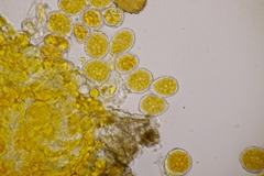 Chrysomyxa rhododendri