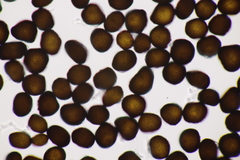 Anthracoidea pratensis