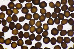 Anthracoidea pratensis