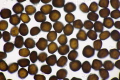 Anthracoidea pratensis