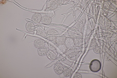 Plasmopara laserpitii