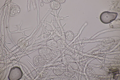 Plasmopara laserpitii