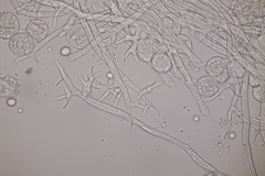 Plasmopara laserpitii