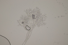 Hyaloperonospora galligena