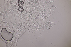 Hyaloperonospora galligena