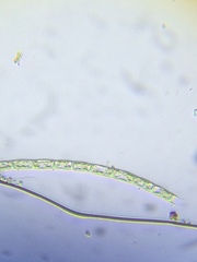 Microspora