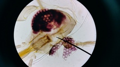 Phlebotominae