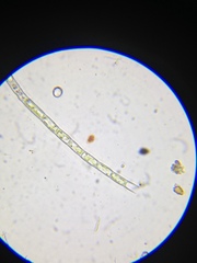 Microspora