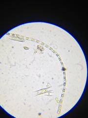 Stichococcus