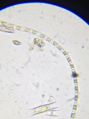 Stichococcus