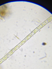 Microspora
