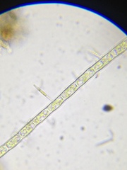 Microspora