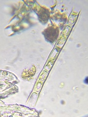 Microspora