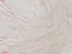 Hymenoscyphus albopunctus