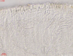 Hymenoscyphus albopunctus