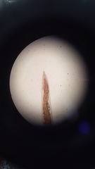 Ancylostoma