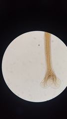 Ancylostoma