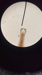 Ancylostoma
