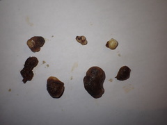 Xanthoteras radicola