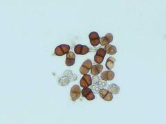 Puccinia actaeae-elymi