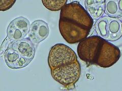 Puccinia actaeae-elymi