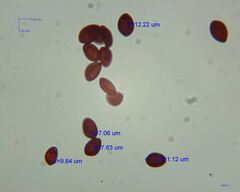 Panaeolus subbalteatus