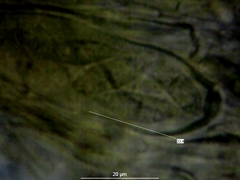 Enchylium polycarpon