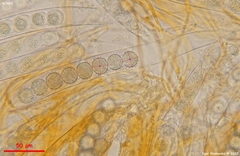 Ramsbottomia asperior