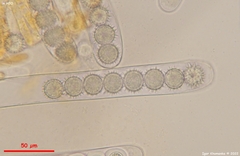 Ramsbottomia asperior