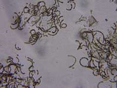 Dolichospermum lemmermannii