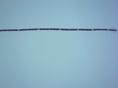 Dolichospermum planctonicum