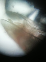 Ostracoda