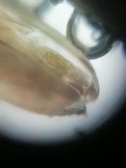 Ostracoda