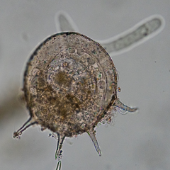 Centropyxis aculeata