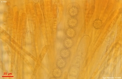 Ramsbottomia asperior