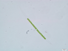 Closterium acutum