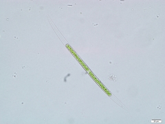 Closterium acutum