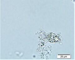 Strobilidium