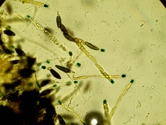 Rosellinia aquila