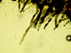 Rosellinia aquila