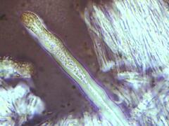 Dacryobolus karstenii